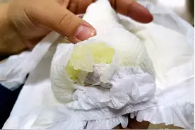 漏“珠”惹宝妈担心 月嫂教您正确使用纸尿裤图片
