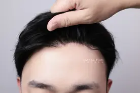 固定假发用夹扣还是胶粘呢？想戴着健身，还是选后者吧图片