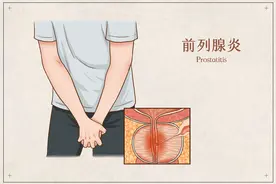 10个男人9个前列腺有病，男人前列腺炎应该注意这3点图片