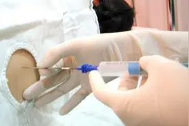 7张图揭露产妇“剖腹产”全过程，男人都该看，网友：母爱太伟大图片