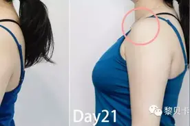 三天就能改善体态的方法，我们亲测简单实用！图片
