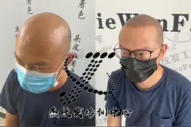 纹发后年轻了十岁图片
