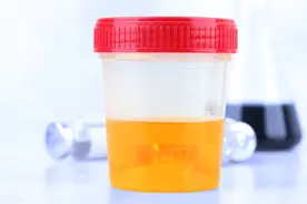 被忽视的尿液，竟是健康的信号灯！这4种颜色，是“五脏”在求救图片