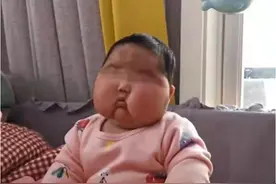 5个月婴儿用了“毒面霜”，额头汗毛猛增，脸蛋像200斤成人图片