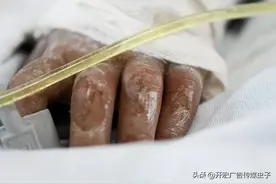 孩子烫伤或影响一生，无数悲剧警示父母，让孩子远离这几点图片