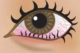 别忽视，宝宝频繁眨眼揉眼未必是困图片