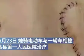 “老子又不是吃干饭的，我还能做错了？”从医30载错把右肩割左肩图片