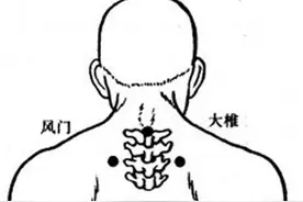 “退烧三穴”的应用，兼顾“标”与“本”图片