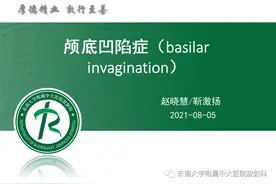 颅底凹陷症图片
