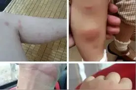 夏季必备| 电蚊拍+灭蚊灯2合1，还能挂上墙的“灭蚊神器”！图片