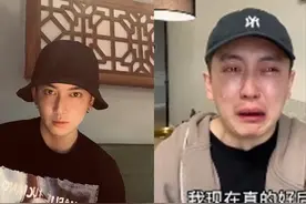 知名网红金大威因整形失败变成丑八怪，老20岁痛哭：我好后悔图片