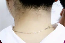 脖子周围的小肉粒，不痛也不痒，该怎么处理？能抠掉吗？图片