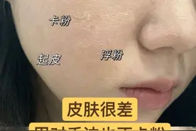 粉底液直接抹？难怪脱妆斑驳，想要打造自然底妆，这四点是关键图片