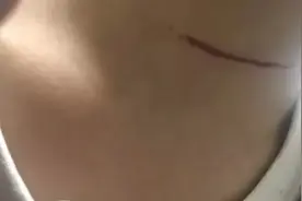 河北一女士骑车路上遭“暗算”！警惕这一隐形“杀手”！图片