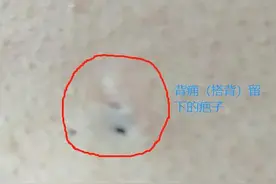 单方气死名医图片