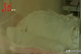 14岁女孩，全身烧伤面积达90%！现急需救治图片