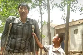 山东第一高人徐大个，身高比姚明还高14公分，现在仍依靠双拐走路图片