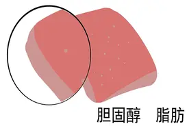 反式脂肪酸：导致全球每年约50万人死亡！这5种食物，该拉黑了图片