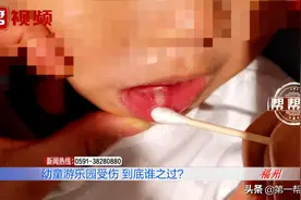 心疼！两岁幼童游乐园磕裂下唇，缝了八针，场馆方直喊冤图片