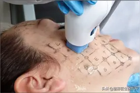 6个快问快答，给想做"热玛吉"的人一些真实的建议图片