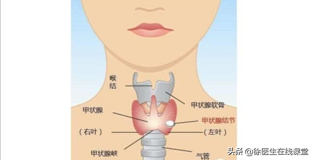 甲状腺结节有什么忌口 2026年甲状腺结节10大忌口＂,＂no_ai_sug＂:true},{＂
