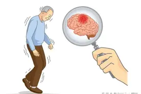 健康·科普 | 知“帕”不怕，带你了解帕金森图片