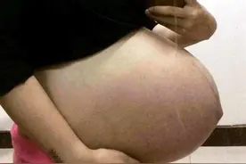 肚脐凹凸预示胎儿性别？“凹进去”和“凸出来”的区别，孕妈要懂图片