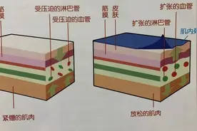 运动员身上贴的胶布是干什么用的呢?普通人可以贴吗?图片