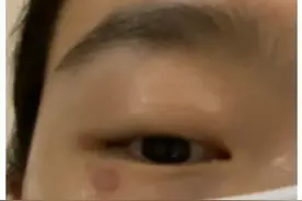 关灯玩手机，引来一只虫子，美女说“差点毁容”图片