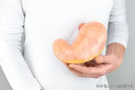 胃癌，手术切除了三分之二的胃之后......图片