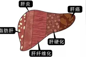 猪为什么不得脂肪肝，不得糖尿病？图片