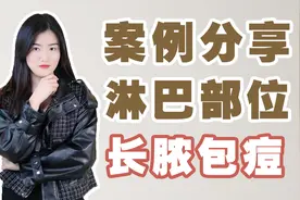 为什么淋巴部位会长痘痘，淋巴部位长痘痘怎么办？视频封面