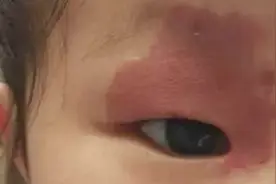 这里长痣可不是小福星，可能趁机要娃命图片