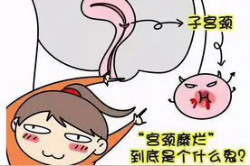 宫颈糜烂不用治？宫颈糜烂能自行恢复吗？医生辟谣来了图片