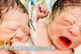 女子节育环避孕失败，男婴手握节育环出生，网友：是个了不起的人图片