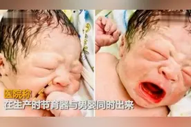 女子节育环避孕失败，男婴手握节育环出生，网友：是个了不起的人图片