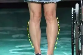 腿型不好看难道真是先天原因吗？不是的，你可能忽略了这3个点图片