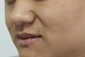 皮肤发黄，是什么原因？皮肤主任建议多吃4种食物，有助祛黄图片