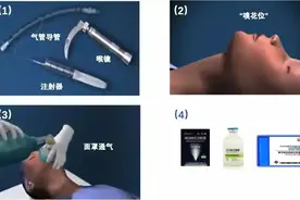 新冠肺炎 | 气管插管怎么做？东直门医院麻醉科大夫详解必备技巧图片
