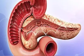 胰腺囊性病变，会癌变吗？图片