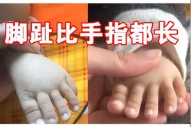 宝宝天生骨骼清奇，“脚趾”长于手指，妈妈不敢给娃穿凉鞋图片
