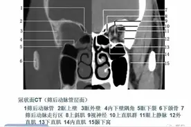 正常眼眶的CT解剖图片