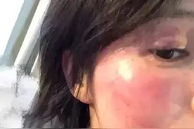 王雨馨被绿又被打？还为爱自杀？至于吗图片