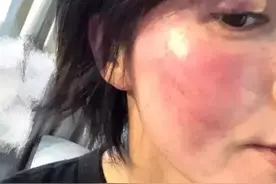 王雨馨被绿又被打？还为爱自杀？至于吗图片
