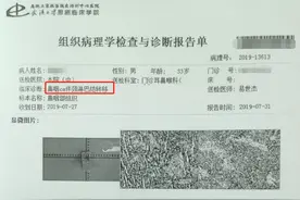33岁壮年查出鼻咽癌，已做6次化疗！呼吁：这些症状别当成鼻炎图片