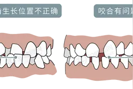 为什么只要戴牙套，牙齿就可以恢复得很整齐？生动展示矫正过程图片