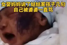 女婴被亲戚小孩涂花脸，宝妈想讨公道，反被婆婆一顿数落图片