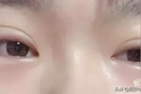 #安心变美课堂##我的安心变美推荐# 眼皮越来越松，怎么办？图片