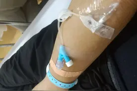 打留置针，让实习生白戳了一针图片