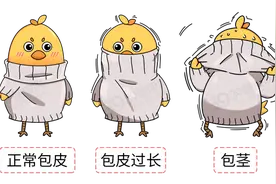 男性私处如何清洗才干净？手把手教你 丨正经科普图片
